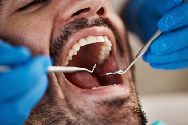 Best Urgent Tooth Repair  in Geneva, FL